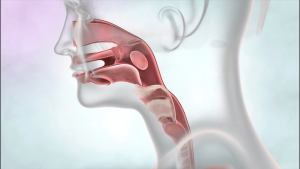गले के कैंसर के लक्षण/Symptoms of Throat Cancer
