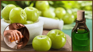आंवला आयुर्वेदिक फायदे लाभ/Amla Ayurvedic Benefits
