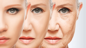 सौंदर्य की दुश्मन झुर्रियां/Wrinkles are the enemy of beauty