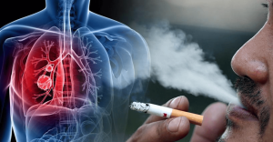 धूम्रपान से लंग कैंसर खतरा/Lung cancer risk from smoking