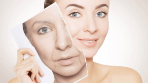 सौंदर्य की दुश्मन झुर्रियां/Wrinkles are the enemy of beauty