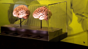मानव मस्तिष्क संग्रहालय/Human Brain Museum