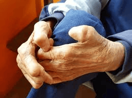 विश्व कुष्ठ रोग दिवस/World Leprosy Day