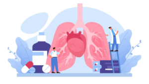 पल्मोनरी एम्बोलिज्म/Pulmonary Embolism